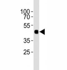 Western blot analysis of lysate from 12 tagged recombinant protein cell lines using HA antibody dilu