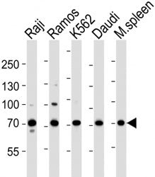 BTK Antibody