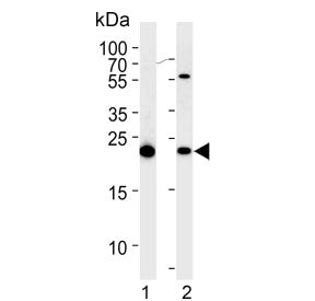 Western blot testing of human 1) HEK293 and 2) HeLa cell lysate with Interleukin-1 Receptor Antagoni