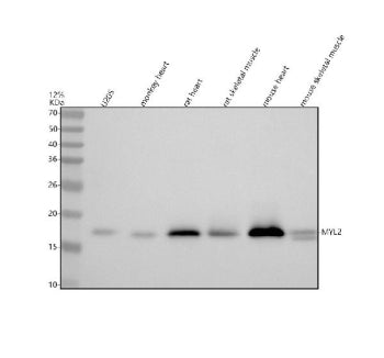 Western blot analysis of Myosin Light Chain 2/MLC-2V/MYL2 using anti-MYL2 antibody. Lane 1: human U2