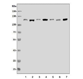 Western blot testing of human 1) HeLa, 2) HEK293, 3) PC-3, 4) COLO-320, 5) HepG2, 6) ThP-1 and 7) A5