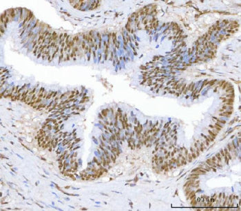 c-Myc Antibody, 100ug