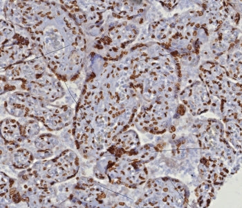 IHC staining of FFPE human placental tissue with dsDNA antibody (clone DSD/8204R). HIER: boil tissue