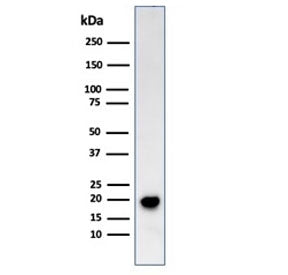 Western blot testing of human COLO-38 cell lysate with Melan-A antibody (clone SPM555). Expected mol