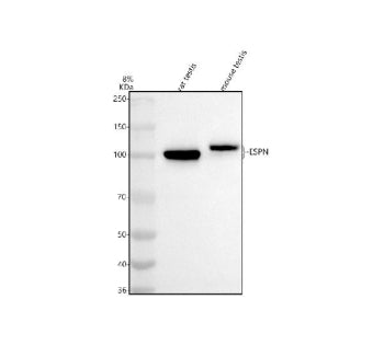 Western blot analysis of ESPN using anti-ESPN antibody. Electrophoresis was performed on a 8% SDS-PA