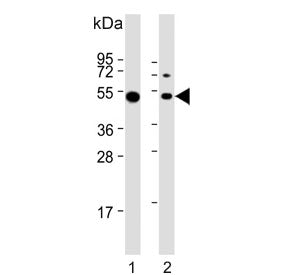 Western blot testing of human 1) Daudi and 2) Ramos cell lysate with Lymphocyte Specific Protein 1 a
