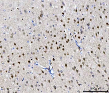CHD1 Antibody / Chromodomain-helicase-DNA-binding protein 1