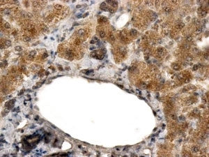 IHC testing of FFPE human liver with ALDH3A2 antibody at 2ug/ml. HIER: steamed with pH6 citrate buff