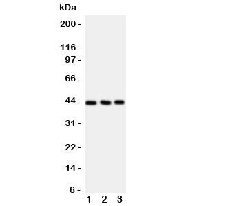CCR9 Antibody