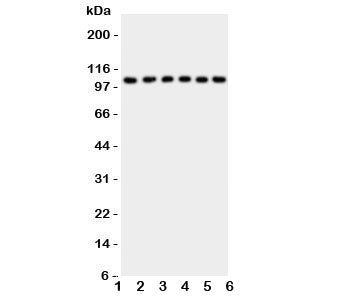 NFKB1 Antibody NF-kB p105/p50