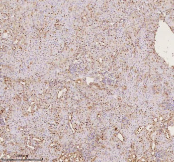 Immunohistochemical staining of PTRHD1 using anti-PTRHD1 antibody. PTRHD1 was detected in a paraffin