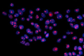 RRS1 Antibody / Ribosome biogenesis regulatory protein homolog