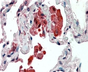 IHC staining of FFPE human lung with IDE antibody at 2.5ug/ml. HIER: steamed with pH6 citrate buffer