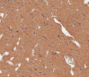 IHC testing of FFPE human brain tissue with MAP1LC3B antibody. HIER: steam section in pH9 EDTA for 2