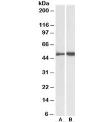 Western blot testing of human plasma [A] and platelet [B] lysates with Fibrinogen gamma chain antibo