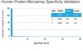 Analysis of HuProt(TM) microarray containing more than 19,000 full-length human proteins using TFIIB
