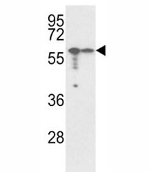 Vimentin Antibody