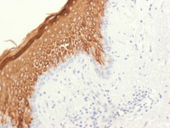 IHC testing of FFPE human skin with recombinant CK10 antibody (clone KRT10/1948R). Required HIER: bo