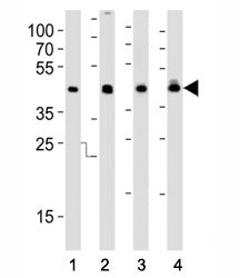 Western blot analysis of lysate from (1) HepG2, (2) MCF-7 cell line, (3) human liver and (4) rat liv