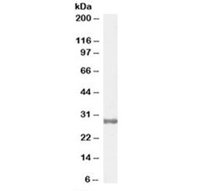 Western blot testing of human testis lysate with COMT antibody at 0.3ug/ml. Predicted molecular weig