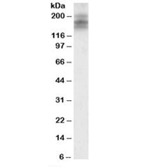Western blot testing of human cerebellum lysate with DSCAM antibody at 2ug/ml. Predicted molecular w