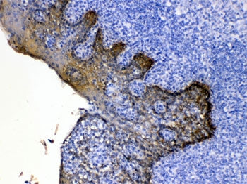 Cytokeratin 5 Antibody