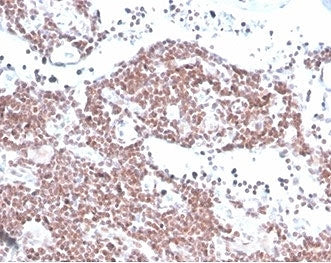 IHC staining of FFPE human lymph node tissue with MGMT antibody (clone MGMT/4791). HIER: boil tissue