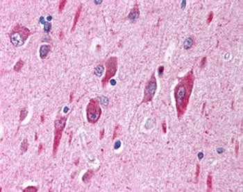 IHC testing of FFPE human cerebellar cortex with PI3K antibody at 2.5ug/ml. HIER: steamed with pH6 c
