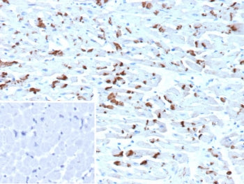 IHC staining of FFPE human heart tissue with CDH2 antibody (clone CDH2/9492). Inset: PBS used in pla