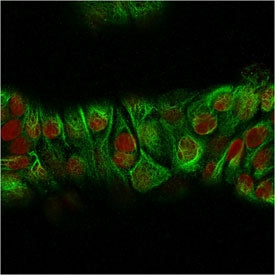 Immunofluorescent staining of MeOH-fixed human MCF7 cells with recombinant Basic Cytokeratin antibod