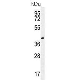 Western blot testing of human NCI-H460 cell lysate with Gamma-glutamyl hydrolase antibody. Expected 