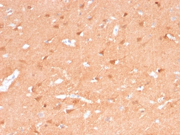 IHC staining of FFPE human cerebellum tissue with recombinant PGP9.5 antibody (clone rUCHL1/775). Re