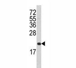 FAS Antibody