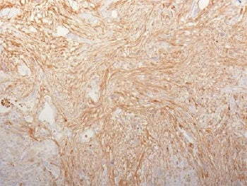 FN1 Antibody / Fibronectin
