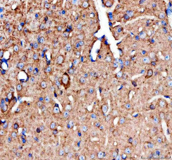 IHC staining of FFPE mouse spinal cord with Chat antibody. HIER: boil tissue sections in pH8 EDTA fo