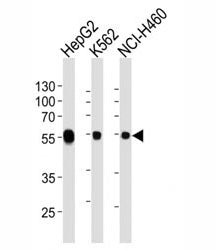 ALDH1A1 Antibody / Acetaldehyde dehydrogenase 1, 0.4ml