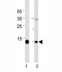 Myoglobin Antibody