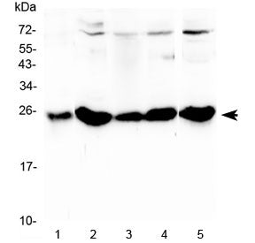 Plgf Antibody / Pgf / Placenta growth factor
