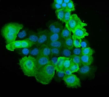 S100A6 Antibody