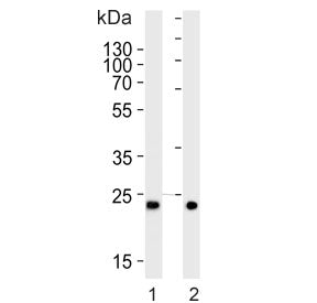 Mitochondrial phospholipase Antibody / MitoPLD / PLD6