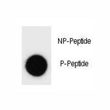 Phospho-IKKB Antibody (pS689)