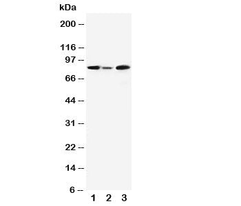 Western blot testing of MCM5 antibody and Lane 1: rat testis; 2: rat brain; 3: Jurkat cell lysate. E