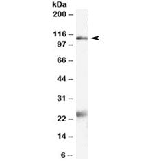 Western blot testing of rat brain lysate with NR1 antibody at 2ug/ml. Molecular weight: the expected