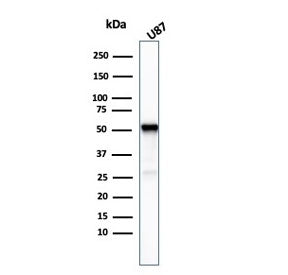 Western blot testing of human U-87 cel lysate with Beta Tubulin antibody (clone TUBB3/3732). Predict