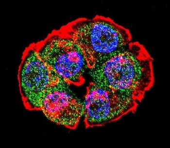 Immunofluorescent staining of fixed and permeabilized human T-47D cells with Catenin Beta antibody (
