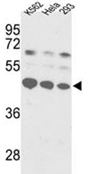 SS-B Antibody