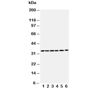 Cyclin D1 Antibody