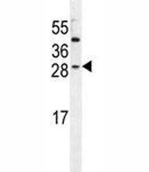 IGF2 antibody western blot analysis in HeLa lysate. Predicted molecular weight: 20, 20, 26 kDa (isof