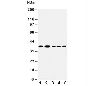 Western blot testing of Angiopoietin 2 antibody and Lane 1: Recombinant human ANGPT2 protein 10ng; 2