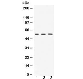 Fibrinogen beta chain Antibody (FGB)